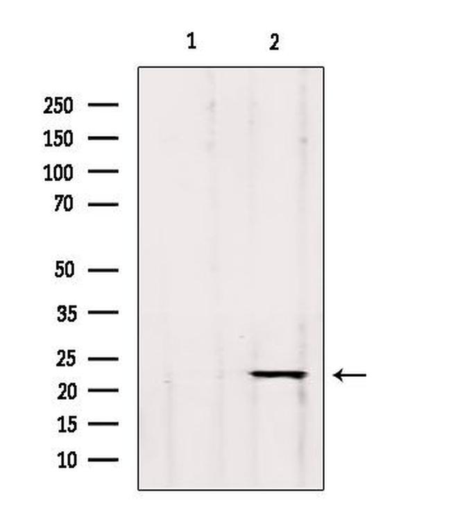 GP1BB Antibody in Western Blot (WB)