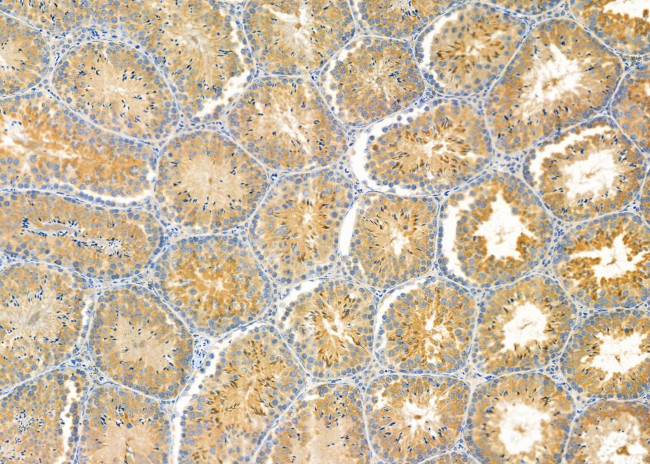 PABPC4 Antibody in Immunohistochemistry (Paraffin) (IHC (P))