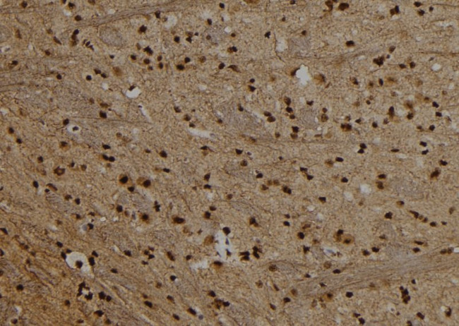 PRDM10 Antibody in Immunohistochemistry (Paraffin) (IHC (P))