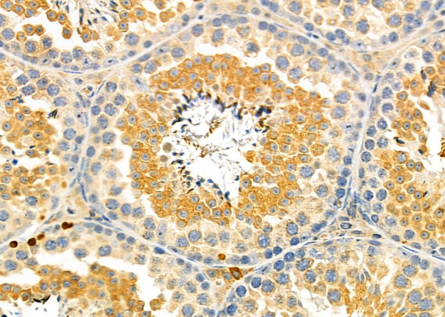 PBX4 Antibody in Immunohistochemistry (Paraffin) (IHC (P))
