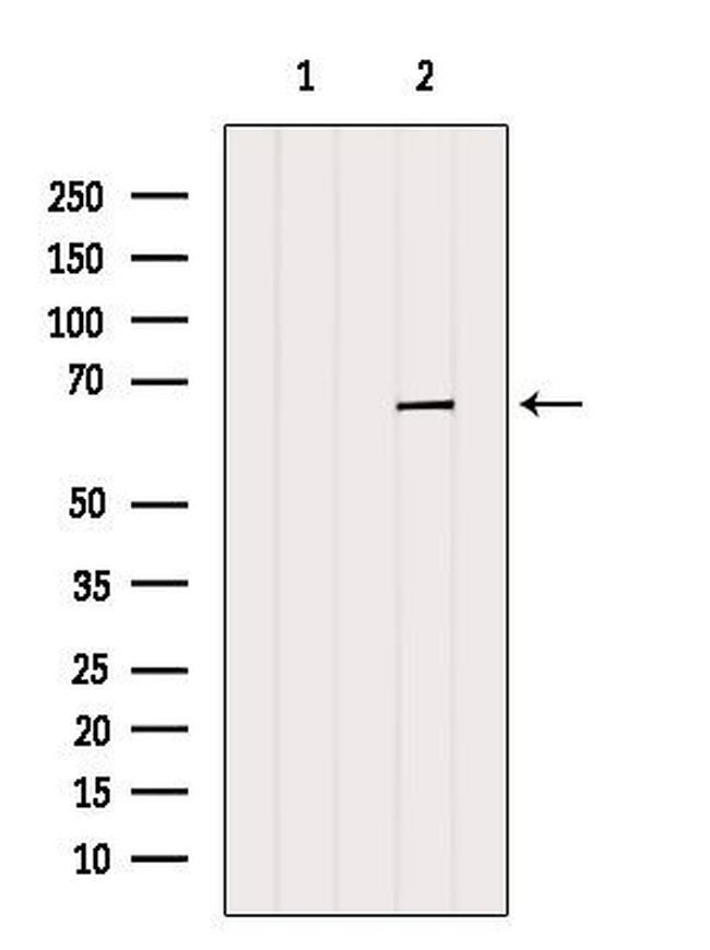 PR38B Antibody in Western Blot (WB)
