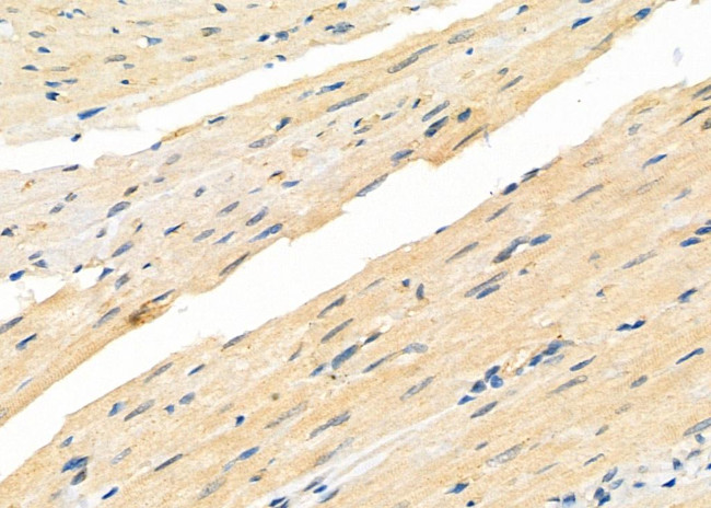 PP14B Antibody in Immunohistochemistry (Paraffin) (IHC (P))