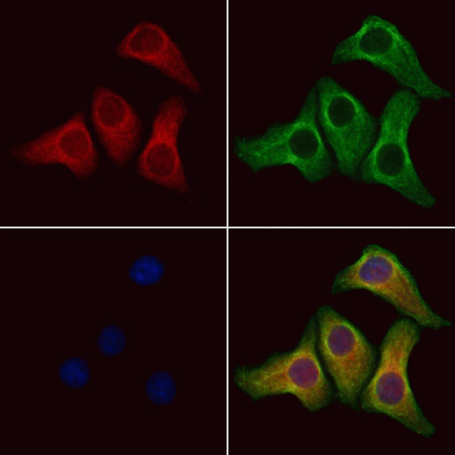 PPP1R2P3 Antibody in Immunocytochemistry (ICC/IF)