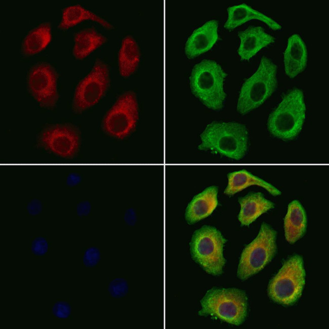 S100A7 Antibody in Immunocytochemistry (ICC/IF)