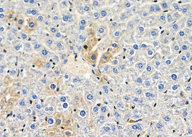 SERPINA10 Antibody in Immunohistochemistry (Paraffin) (IHC (P))