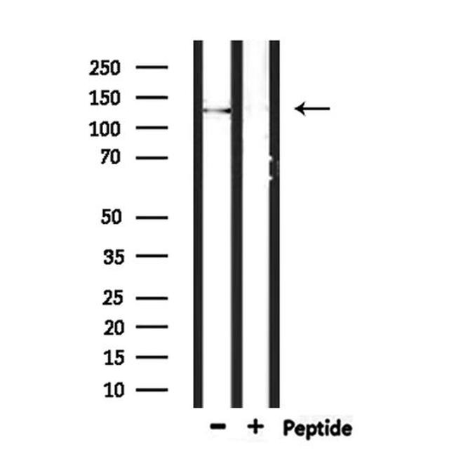 SCAF8 Antibody in Western Blot (WB)