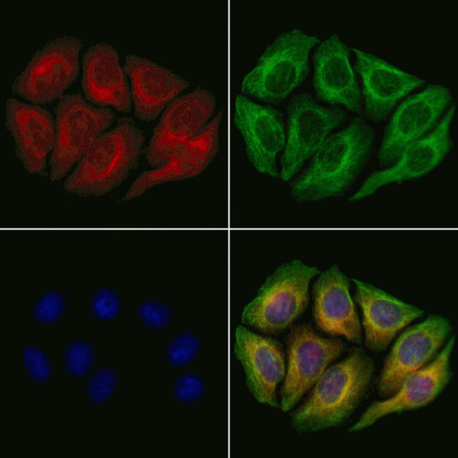 REPS2 Antibody in Immunocytochemistry (ICC/IF)