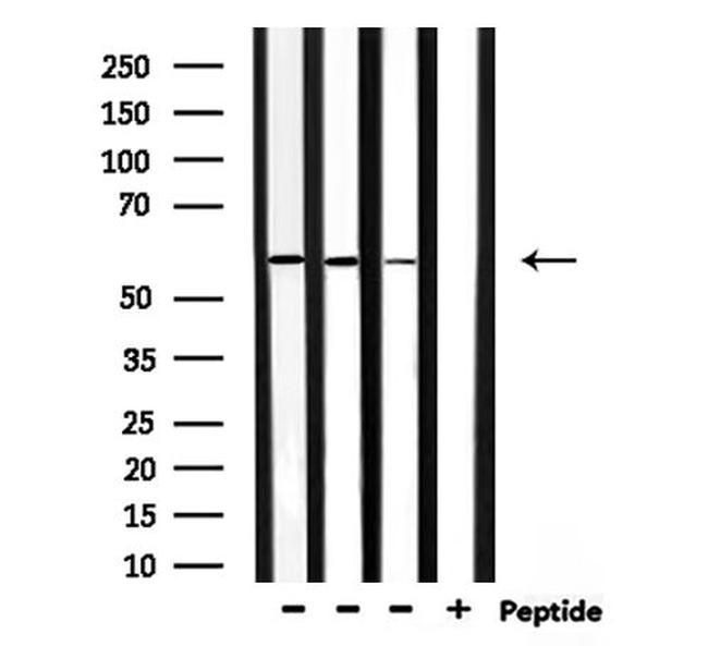 RASGEF1B Antibody in Western Blot (WB)