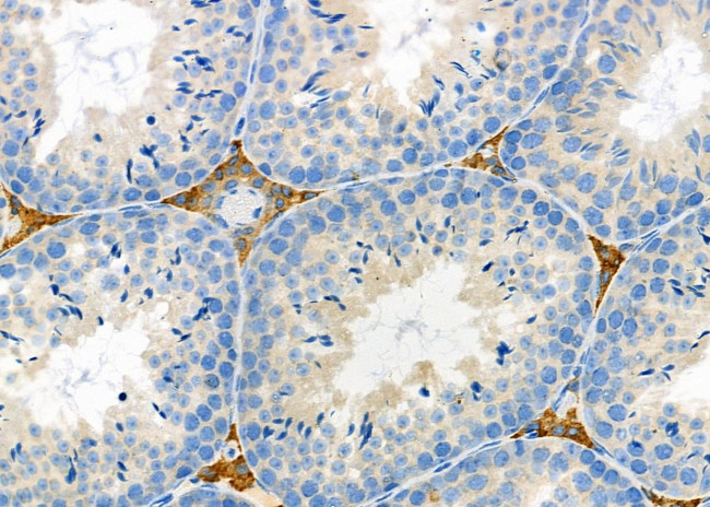 RASGEF1C Antibody in Immunohistochemistry (Paraffin) (IHC (P))