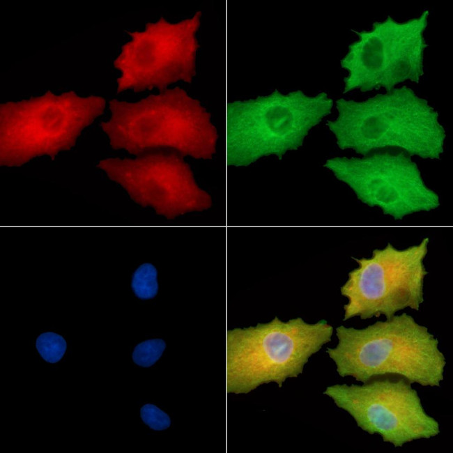 RERG Antibody in Immunocytochemistry (ICC/IF)