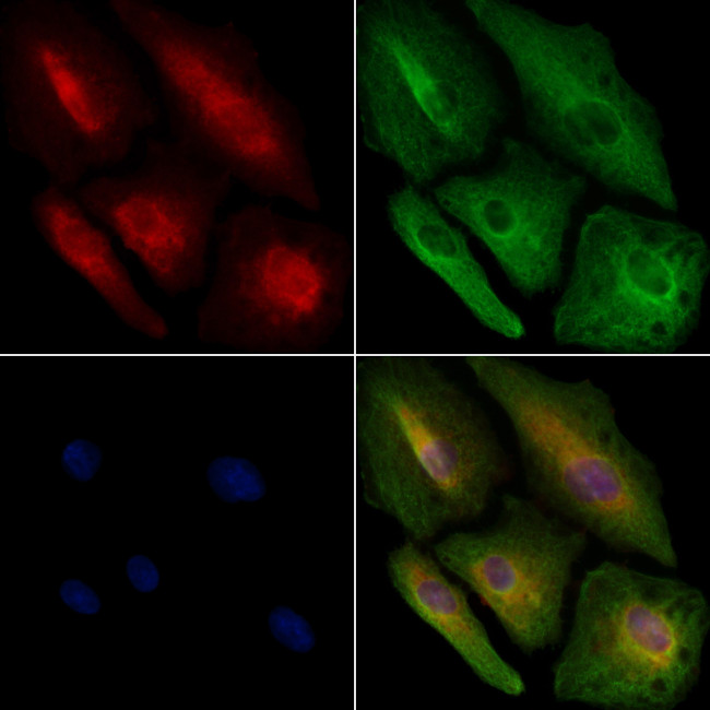 RAB15 Antibody in Immunocytochemistry (ICC/IF)