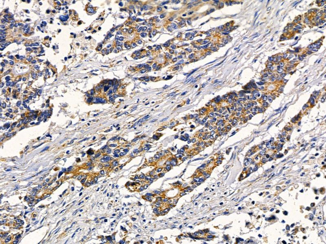 RAB21 Antibody in Immunohistochemistry (Paraffin) (IHC (P))