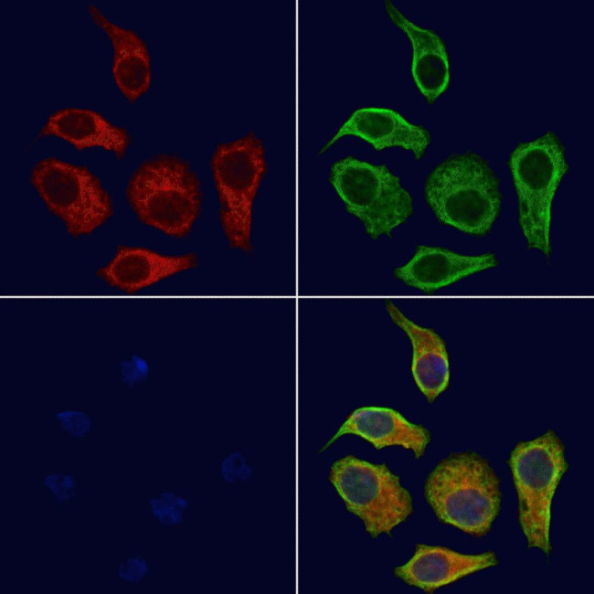 RAB39B Antibody in Immunocytochemistry (ICC/IF)