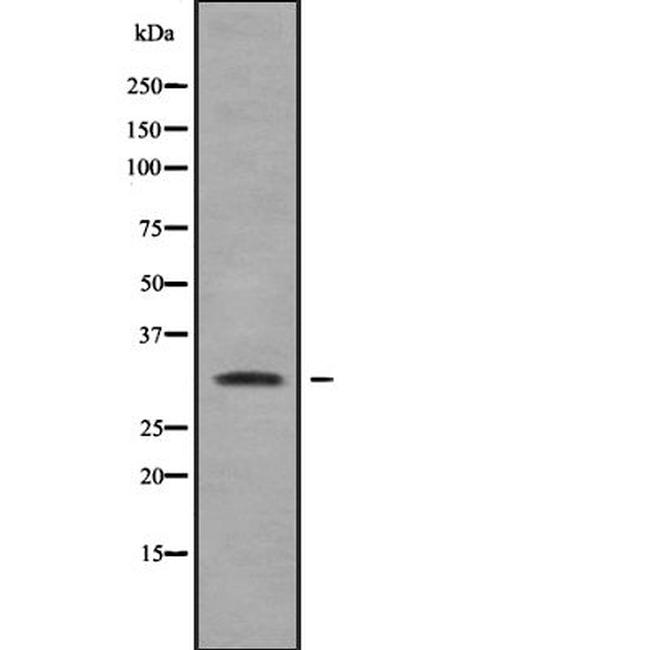 RAB40A Antibody in Western Blot (WB)