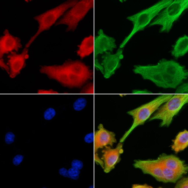 RAB40C Antibody in Immunocytochemistry (ICC/IF)