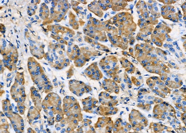 RAB8B Antibody in Immunohistochemistry (Paraffin) (IHC (P))