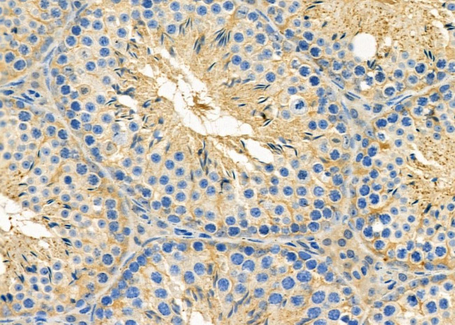 PTPRB Antibody in Immunohistochemistry (Paraffin) (IHC (P))