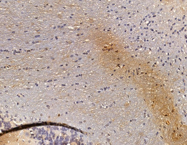 RGS17 Antibody in Immunohistochemistry (Paraffin) (IHC (P))