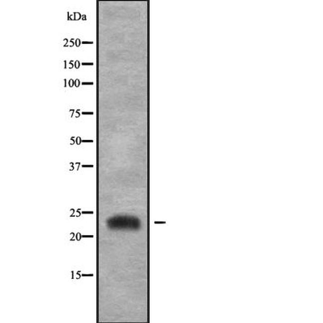 RGS4 Antibody in Western Blot (WB)