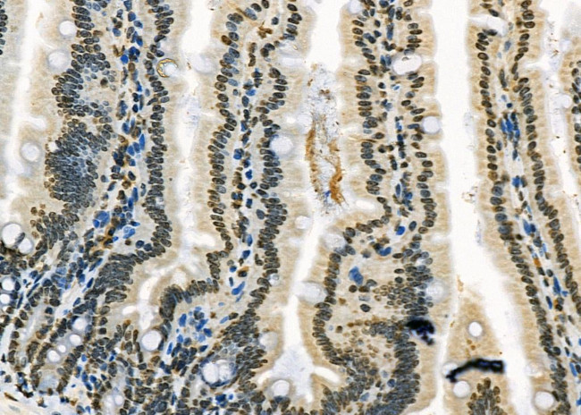 RFPL2 Antibody in Immunohistochemistry (Paraffin) (IHC (P))