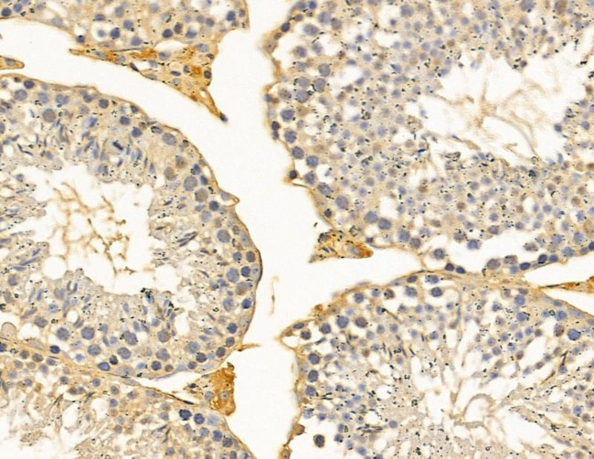 RBBP6 Antibody in Immunohistochemistry (Paraffin) (IHC (P))