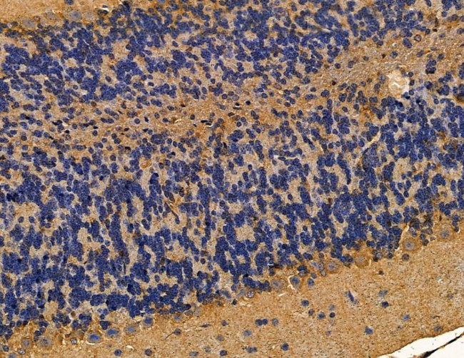 ARHGAP20 Antibody in Immunohistochemistry (Paraffin) (IHC (P))