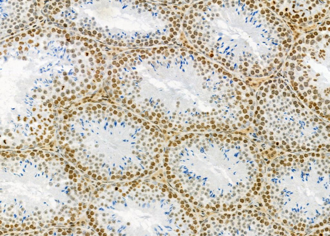 ARHGAP23 Antibody in Immunohistochemistry (Paraffin) (IHC (P))