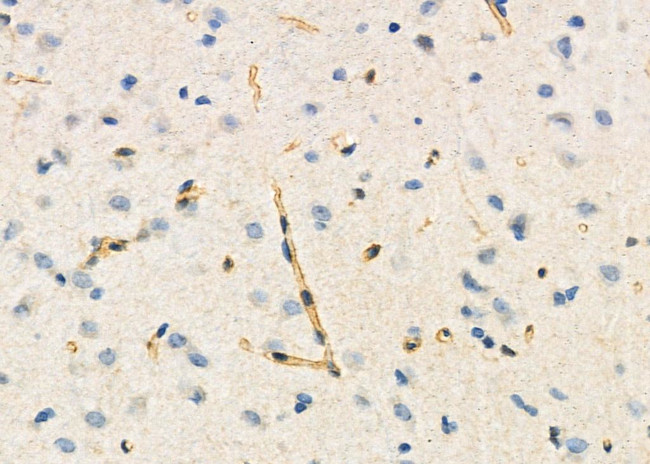 ARHGAP30 Antibody in Immunohistochemistry (Paraffin) (IHC (P))