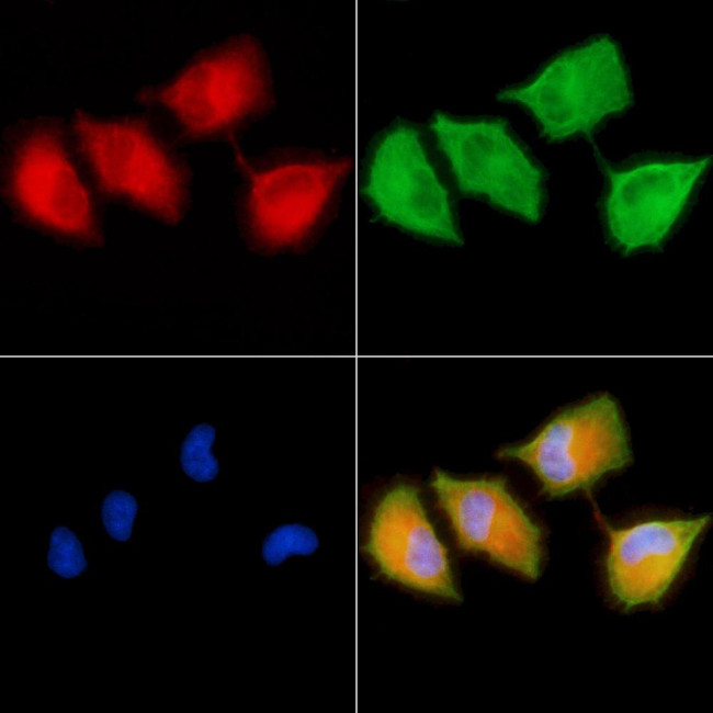 ARHGAP6 Antibody in Immunocytochemistry (ICC/IF)