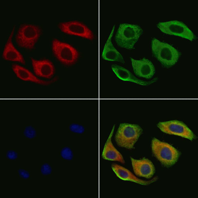 ARHGEF6 Antibody in Immunocytochemistry (ICC/IF)