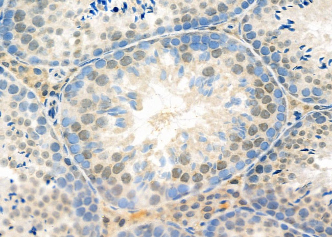 RhoF Antibody in Immunohistochemistry (Paraffin) (IHC (P))