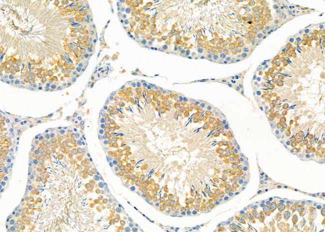 RND2 Antibody in Immunohistochemistry (Paraffin) (IHC (P))