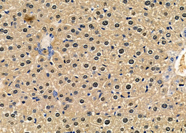 RHOXF1 Antibody in Immunohistochemistry (Paraffin) (IHC (P))