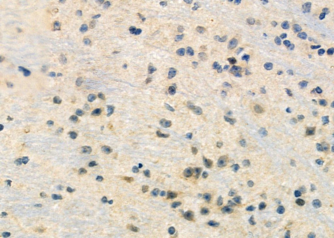 RPL22/RPL22L1 Antibody in Immunohistochemistry (Paraffin) (IHC (P))