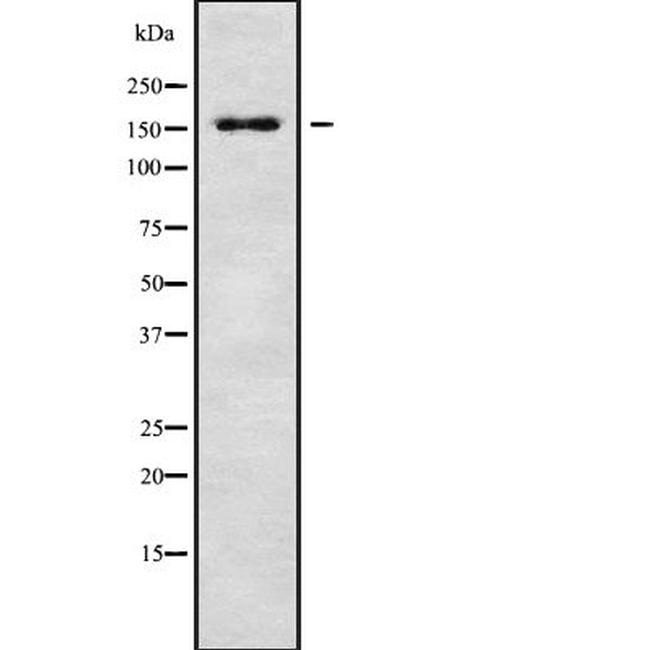 RPAP1 Antibody in Western Blot (WB)