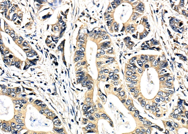 SEPT11 Antibody in Immunohistochemistry (Paraffin) (IHC (P))