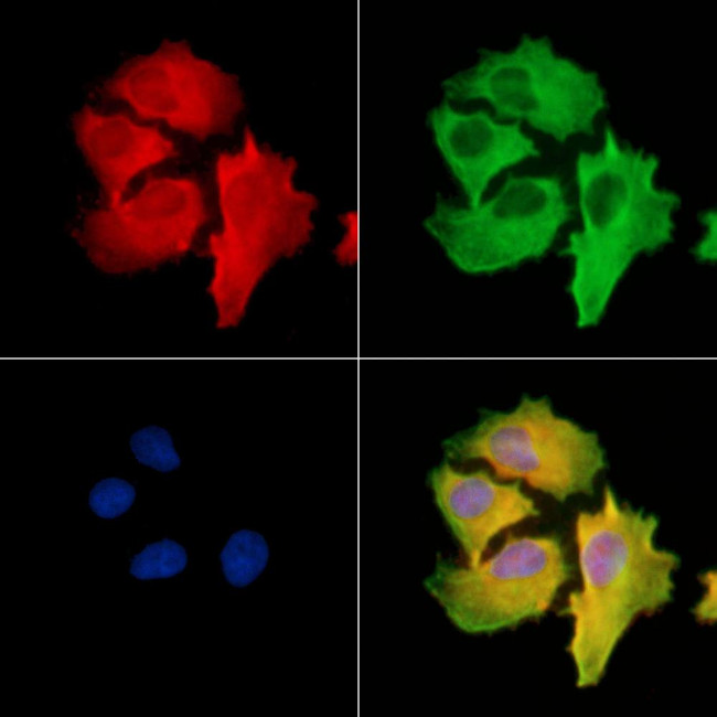 STK31 Antibody in Immunocytochemistry (ICC/IF)