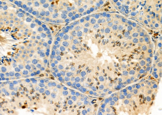 STK38L Antibody in Immunohistochemistry (Paraffin) (IHC (P))