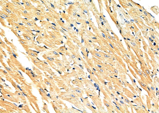 NEK4 Antibody in Immunohistochemistry (Paraffin) (IHC (P))