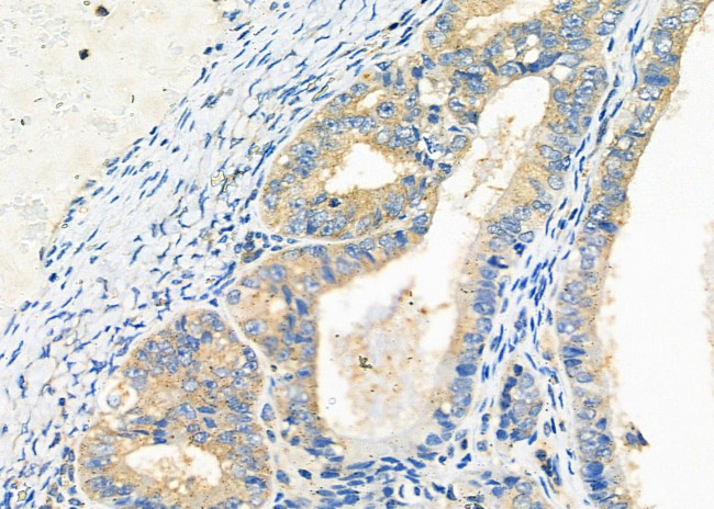 PIM2 Antibody in Immunohistochemistry (Paraffin) (IHC (P))