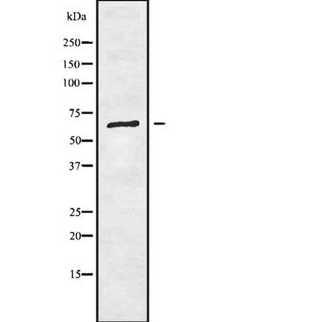 RIOK1 Antibody in Western Blot (WB)