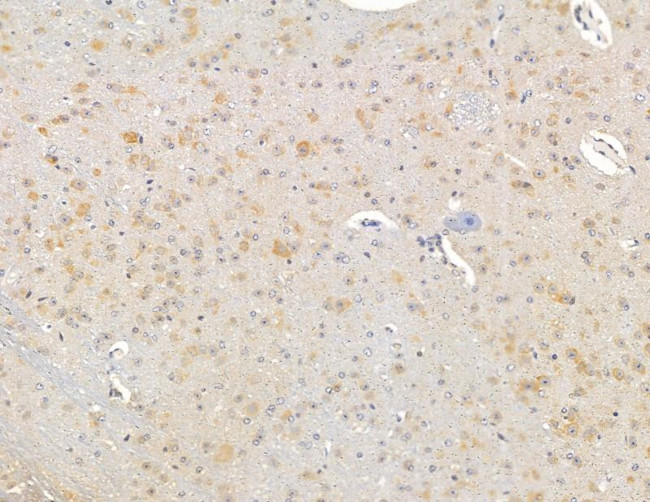 SRPK2 Antibody in Immunohistochemistry (Paraffin) (IHC (P))