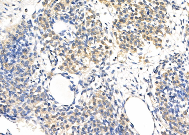 PPP4R1 Antibody in Immunohistochemistry (Paraffin) (IHC (P))