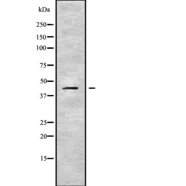SERPINB10 Antibody in Western Blot (WB)