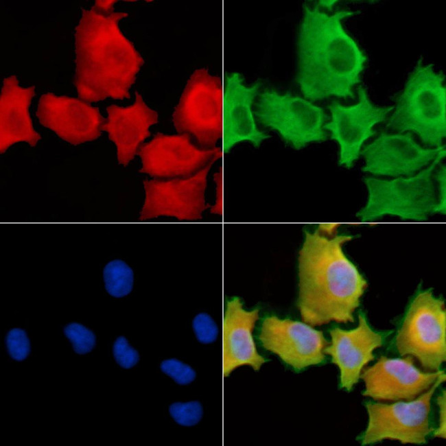 SH3PXD2A Antibody in Immunocytochemistry (ICC/IF)