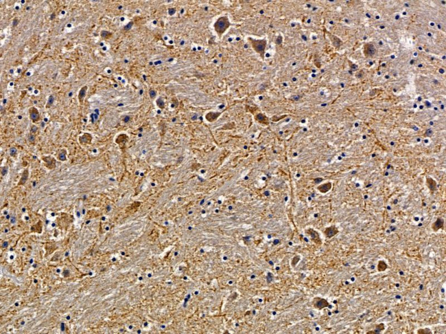 SH3TC2 Antibody in Immunohistochemistry (Paraffin) (IHC (P))