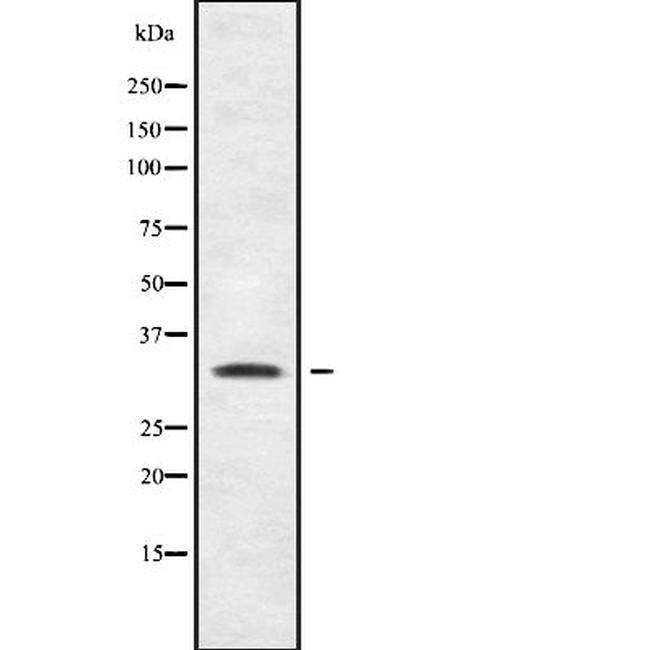 SHOX Antibody in Western Blot (WB)