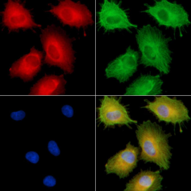 SLC6A18 Antibody in Immunocytochemistry (ICC/IF)