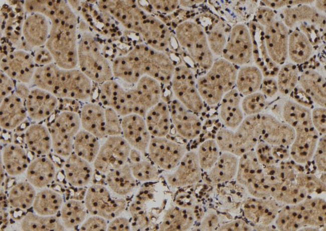 SCNM1 Antibody in Immunohistochemistry (Paraffin) (IHC (P))