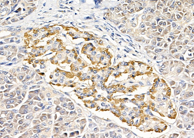 SCN1B Antibody in Immunohistochemistry (Paraffin) (IHC (P))